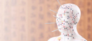 acupuncture