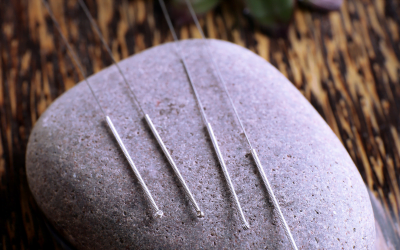 How Acupuncture and Bodywork Can Help You Achieve Your Health Goals